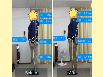 ナオル整体 大宮院(NAORU整体)/猫背が改善して、こりのない姿勢