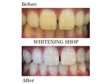 ホワイトニングショップ 池田店の雰囲気(店内は白基調のプライベート空間です。リクライニング付で快適!)