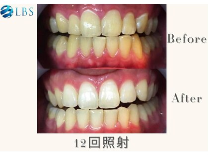 LBSホワイトニング 吉祥寺店の写真