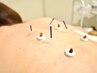 《LINE未登録の方限定》鍼灸スタンダード