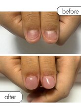 ピノ(pino)/◆深爪矯正＋自爪風仕上げ◆