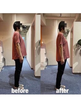 カワル整体 上通り院/美脚の為に知っておくべきこと