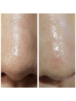 ユフラ(Juhla)/ララピール