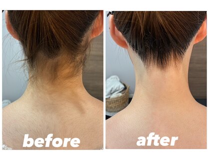 ハーチ(8)の写真