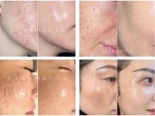 セリンダ(selinda)の雰囲気（肌悩み改善の症例多数☆貴方に最適な施術を肌診断も併せてご提案）