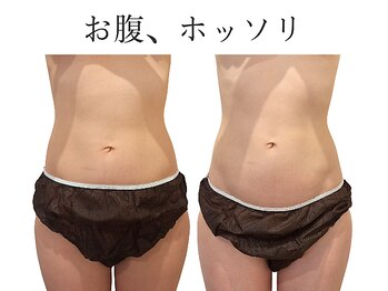 レジスタ(REGISTA)/【筋膜リリース】