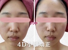 美容整体カラダリメイク(karada)の雰囲気（【４D小顔矯正】歪み/むくみ改善で効果実感！人気メニューです◎）