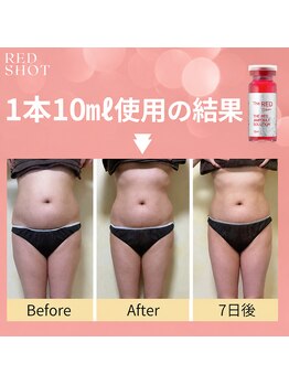 ルアナライフ(Luana Life)の写真/浮き輪肉や二の腕のぷよ肉を集中ケア！筋肉にもアプローチして理想のボディラインへ♪