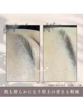 モアトゥインクル 福山宮通り店(MORE twinkle)