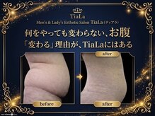 メンズアンドレディース エステティックサロン ティアラ(TiaLa)