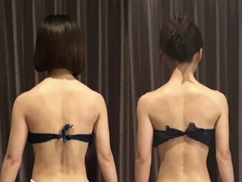 ルギニ(LU.GINI)の写真/効果が凄い。サイズダウン＆リラクが大人気。肩こり改善。見た目も別人級。男性セラピストの個人エステ。