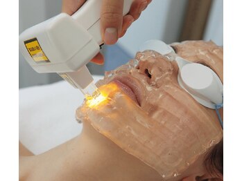 アールアンドビューティー(R&Beauty)/光フェイシャル