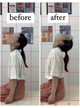 ナオル整体 仙台長町院(NAORU整体)/整体・矯正ビフォーアフター