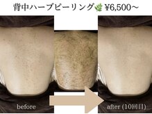 アイル 博多祇園店(iru)/