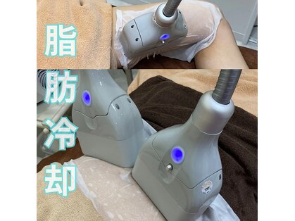 美フレインの写真