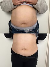 レアレア(Lea l'ea)/一ヶ月後