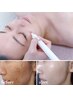 ≪シミが気になる方≫人気No.1鼻頬黒ずみ毛穴肌改善+低周波シミケア¥7800→