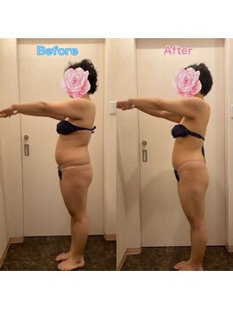 ベルローズ ラパーク 金沢店/痩身ビフォーアフター