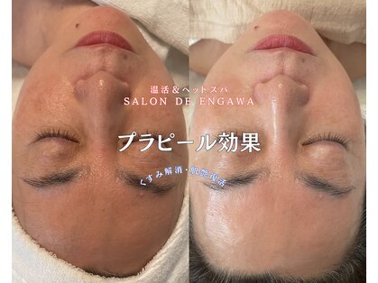 サロンドエンガワ(Salon de ENGAWA)の写真