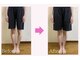 アイキ(aiki)の写真/脚のむくみ・太ももの張り・膝の隙間とサヨナラ！プロの施術で根本改善！真っ直ぐですらっと美しい脚へ♪