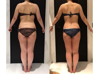 リボディ 表参道(An re Body)/before→after