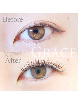 グラース(Grace)/Before→After　両目140本