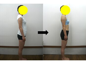 宮崎整体院/【ダイエットコース】