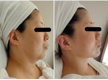 アルモ(ALMO)/2024年は老け見え解消で-10歳！