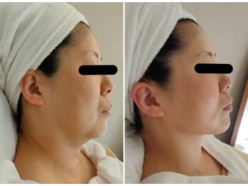 アルモ(ALMO)/2024年は老け見え解消で-10歳！