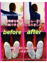 コルギサロン ベルエット(bell'et)/整体の施術前と施術後の比較です