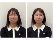 リシュレータ(RISYURE-TA)/