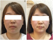 美容整体 ウェリナ 蟹江院/小顔矯正/骨盤矯正/美脚サロン