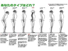 カイロプラクティック輝/姿勢のタイプ