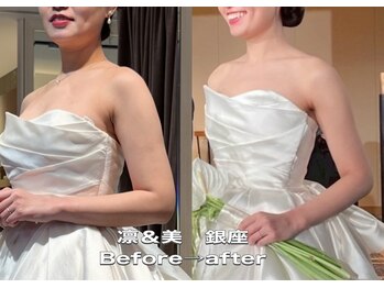 凛&美 銀座/8回施術のビフォーアフター