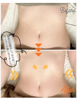 スリモア(SLIMORE)/ビフォーアフター☆お腹