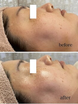 ジェイ(J)/ララピール☆加工なしのハリ艶