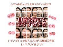 サロン ド 花歩 松山本店/貴女の理想のフェイスラインに♪