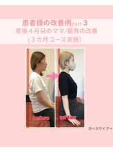 ひがし接骨院/姿勢矯正の改善例