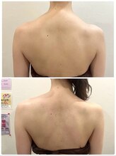 サンク アール(CinQ-R. 美九)/ブライダル