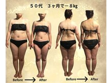 サンテボーテ(Sante Beaute)/５０代　痩身Before→After