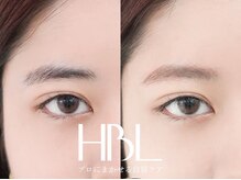 虹 アヌエヌエ(anuenue)/HBLビフォーアフター