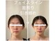 ミラ 長崎駅前店(MIRA)の写真