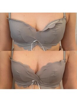 サロン ド ミモザ(Salon de Mimosa)/バストアップお試し