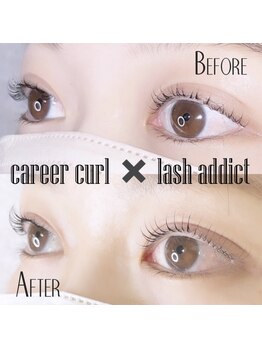 アンストン ボーテ(Instant de beaute)/【まつげのビフォーアフター】