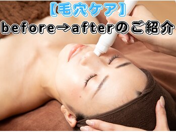 サロン エイトミー(salon 83)/【毛穴ケア】特集》》》