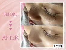 クリアラボ 川崎(Clear Lab)/韓国肌管理&毛穴洗浄専門店