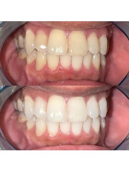 ライトビューティー 池袋店(LightBeauty)/症例写真