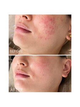 サンジュウロクドゴブ(36.5℃)/レストセルトリートメント