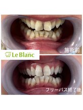 ルブラン 奈良店(Le Blanc)/2周目のフリーパス！