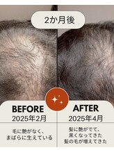 美容の宝石箱/50代/悩み:髪の毛/2か月後